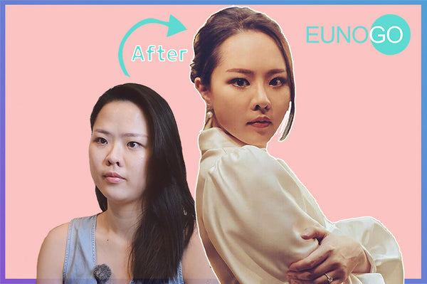 Sophia’s Cosmetic Surgery Makeover in Korea