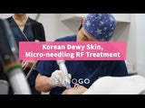 Korean Dewy Skin, Micro-needling RF Treatment
